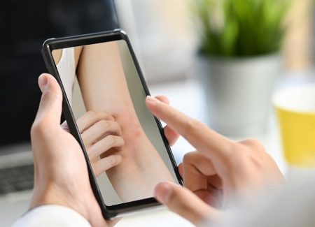 Auf dem Display eines Smartphones ist ein gerötetes Hautbild zu sehen